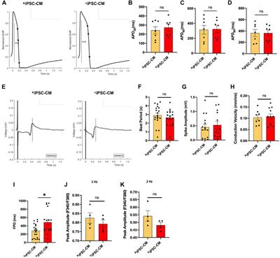 Comparative analysis of the cardiomyocyte differentiation potential of induced pluripotent stem cells reprogrammed from human atrial or ventricular fibroblasts